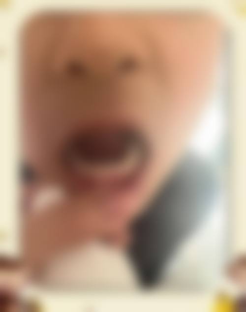 八、沈阳欢乐仁爱口腔(新民分院)怎么预约?