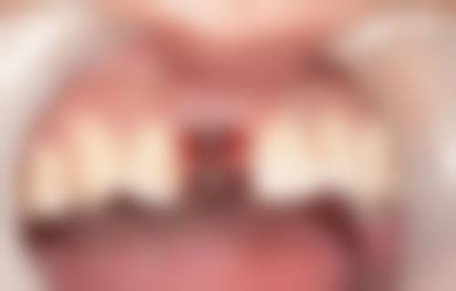 五、莆田长青口腔·种植矫正中 心(梅园店)收费价格表