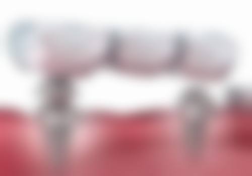 八、郑州郑东新区雅美口腔门诊部怎么预约？