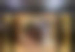 注射瘦腿 国产品牌100单位项目深度解析