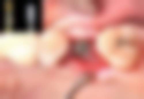 预约优惠活动深圳赛德阳光美添口腔门诊部张瑜璇