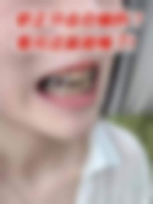 FAQ深圳赛德阳光美添口腔门诊部张瑜璇