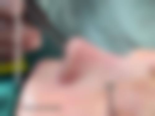 预约优惠活动:预约韦斌医生有什么优惠?