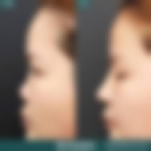 常见问题解答FAQ