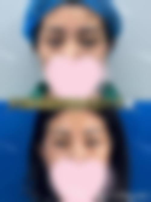 精良设备与服务流程