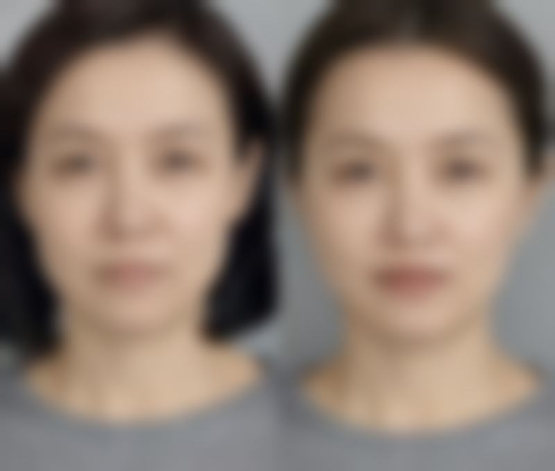 擅长项目详解邵阳华美医疗美容门诊部贾爱军