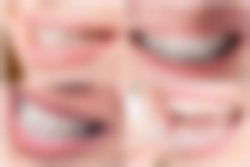 牙龈发炎时能否洗牙需视情况而定