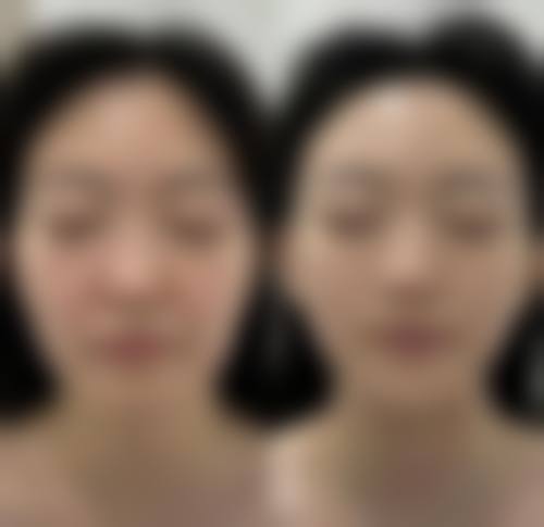预约优惠活动:限时补贴解读