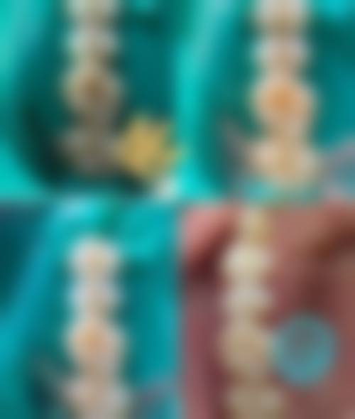 五、湖南湘潭友谊口腔收费价格表