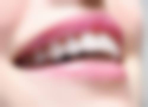 六、江苏省苏州昆山恒立口腔口碑如何？