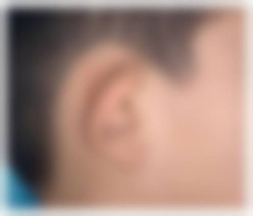 患者真实评价:口碑如何?