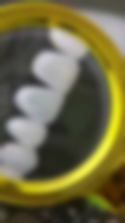 特色项目与骨干医生团队:攻克种植正畸难题