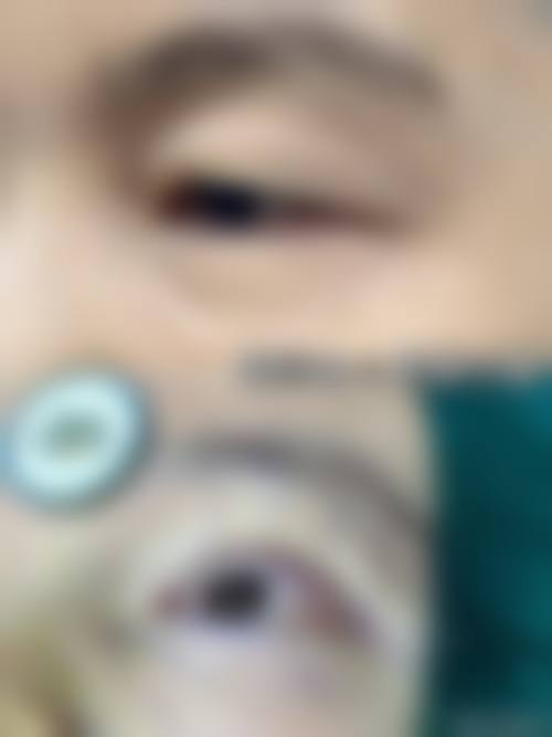 擅长项目详解:精细诊疗与个性化方案