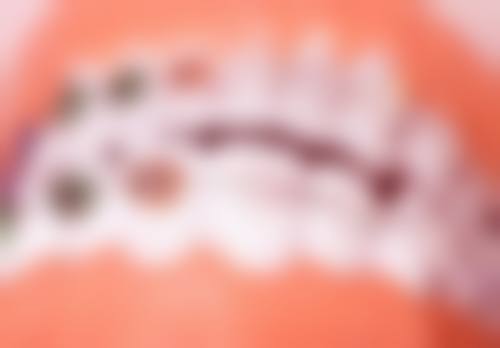 五、德阳口腔陆慧芳医生技术怎么样?
