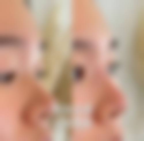 结语:选择正规机构,开启自信人生