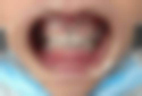 FAQ:关于德阳市口腔医院陈颐医生