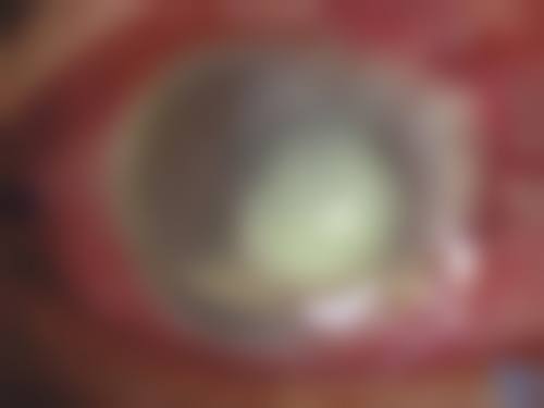 临床实例分享:真实疗效见证