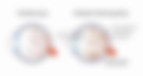 擅长项目详解:曾云暖医生专攻哪些眼病?