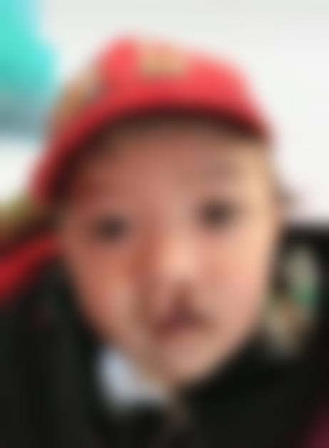 患者真实评价:口碑见证