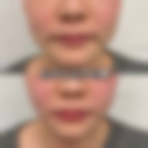 预约优惠活动:限时补贴