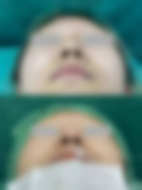 结尾预约号召:开启美丽蜕变