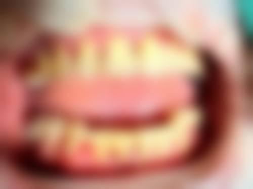 擅长项目详解:王立红医生擅长做我需要的项目吗?