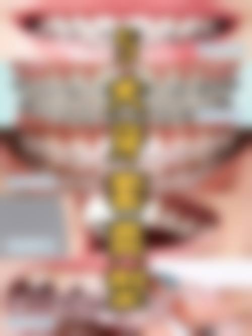 结尾预约号召:大连拜博口腔医院曲学辉