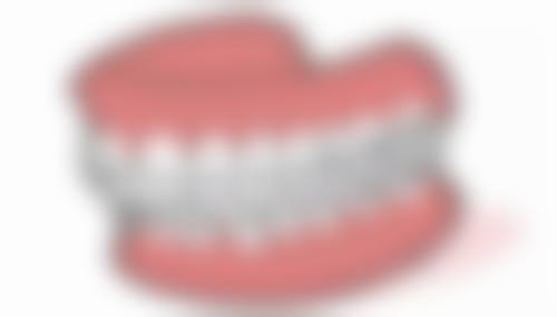 四、秦皇岛博一善口腔特色项目