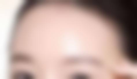 诊疗特色总结:襄阳禾沐三笙医疗美容门诊部祝岑睿的优势