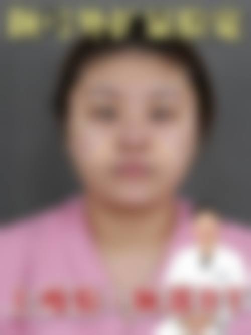 擅长项目详解：双眼皮、隆鼻与内窥镜隆乳