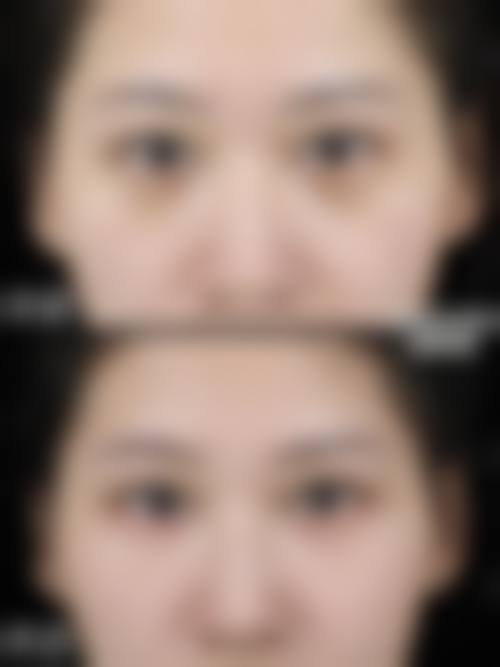 临床实例分享:李燕飞医生的真实反馈