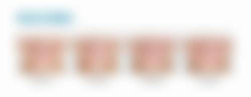 临床实例分享大庆固尔口腔门诊部孙朔
