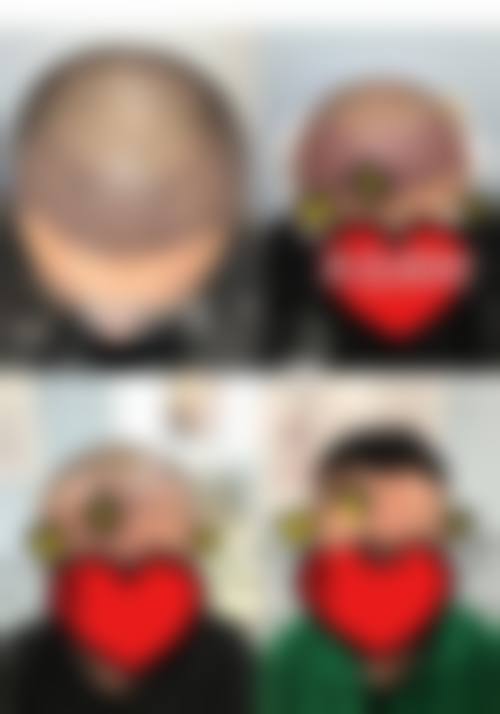 FAQ:关于南宁馥方堂医疗美容诊所黄适的常见问题