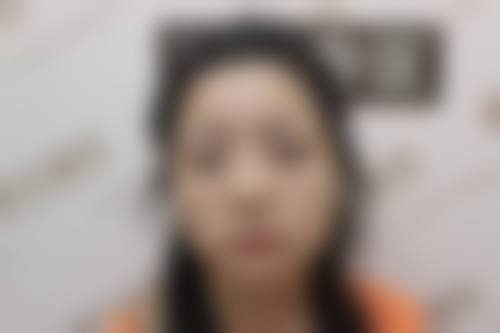 FAQ:襄阳禾沐三笙医疗美容门诊部祝岑睿常见问题