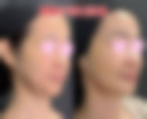诊疗特色总结:李燕飞医生的服务优势