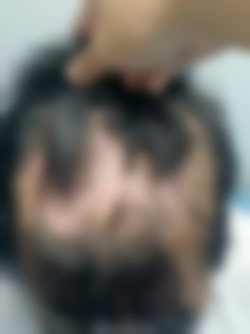 擅长项目详解:南宁馥方堂医疗美容诊所黄适的技术亮点