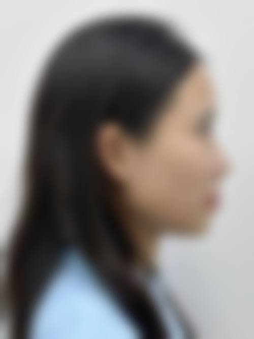 透明化价格体系与优惠活动详情