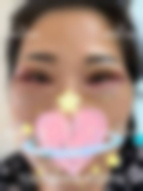 诊疗特色总结:为什么选择金瑶医生?