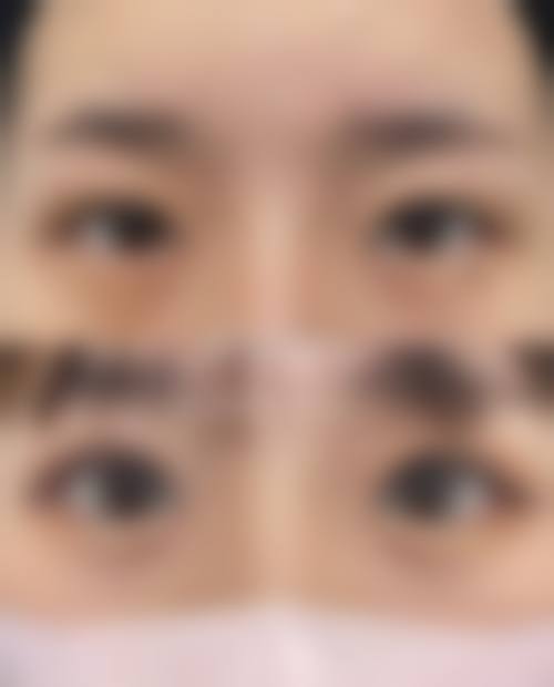 擅长项目详解:襄阳禾沐三笙医疗美容门诊部祝岑睿适合我吗