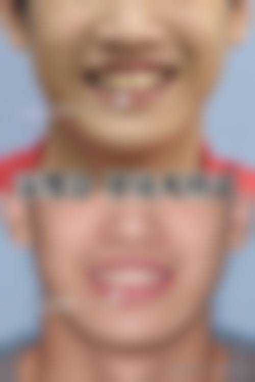 预约优惠活动:限时补贴详情