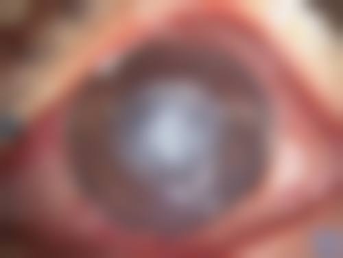 精良设备与特色项目,打造儿童眼健康防护网
