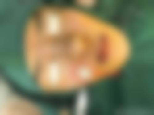 患者真实评价北京星颜医疗美容诊所田文静