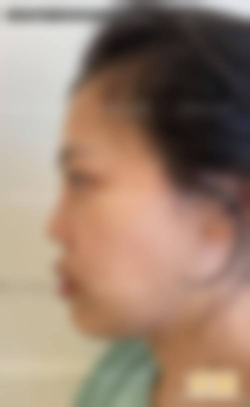 诊疗特色总结北京星颜医疗美容诊所田文静
