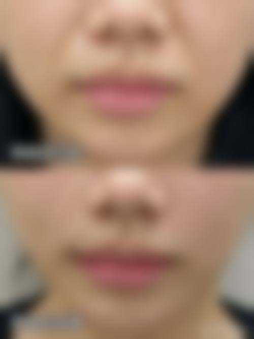 擅长项目详解北京星颜医疗美容诊所田文静