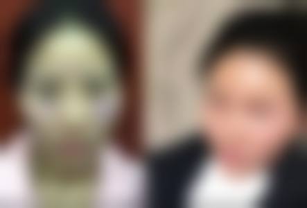 临床实例分享