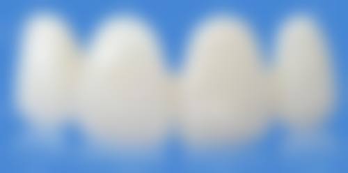 临床实例分享北京牙管家口腔刘海波