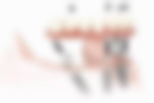 如何应对烤瓷牙对核磁共振的影响