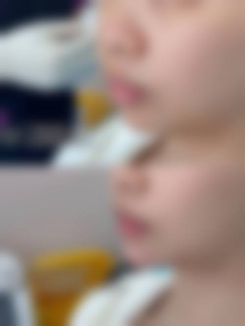 预约优惠活动