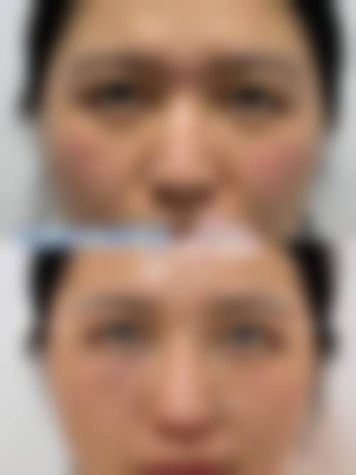 透明价格体系与优惠活动详情
