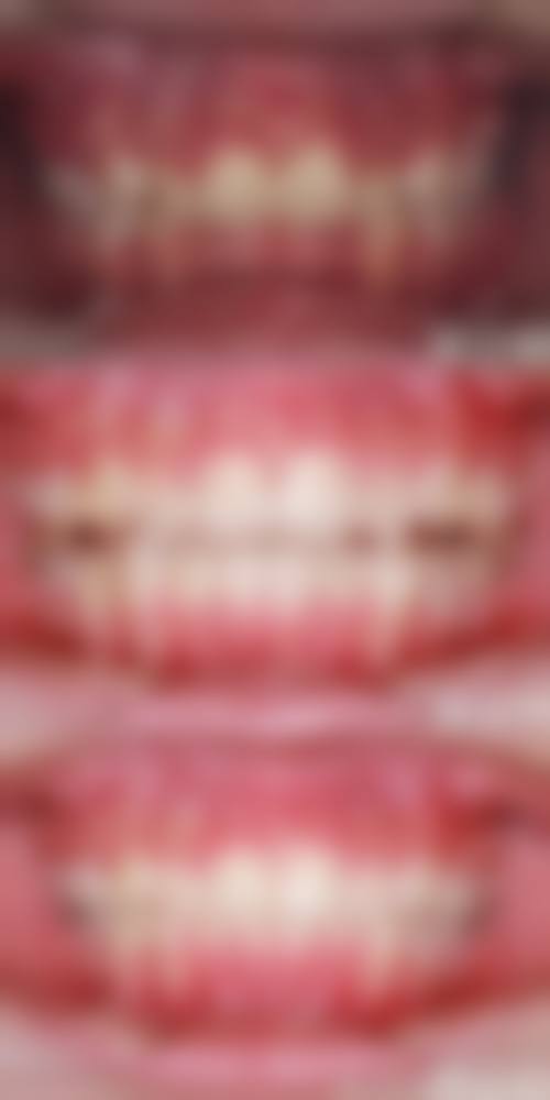 擅长项目详解:哈尔滨淇奥口腔医院孙洪蕊